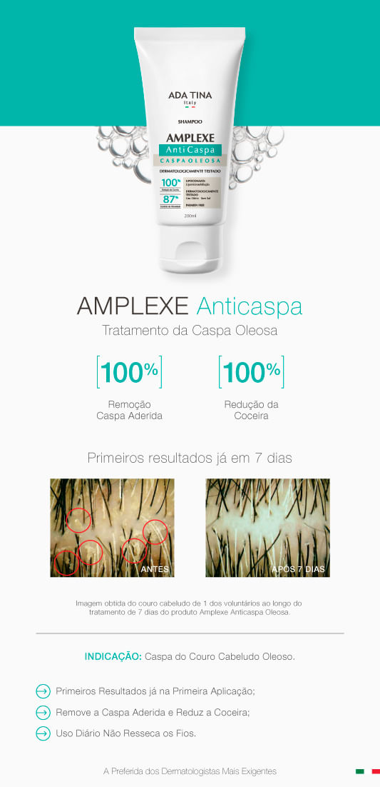 Amplexe Caspa Oleosa Ada Tina Shampoo Anticaspa Epoca Cosmeticos